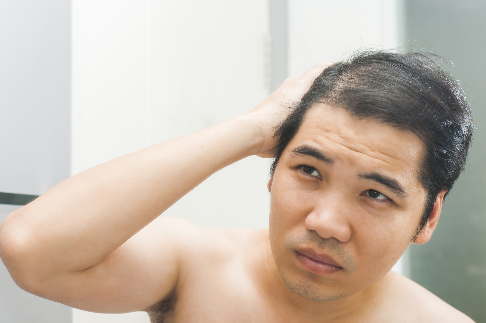 How are Scarring and Non-Scarring Hair Loss Different?