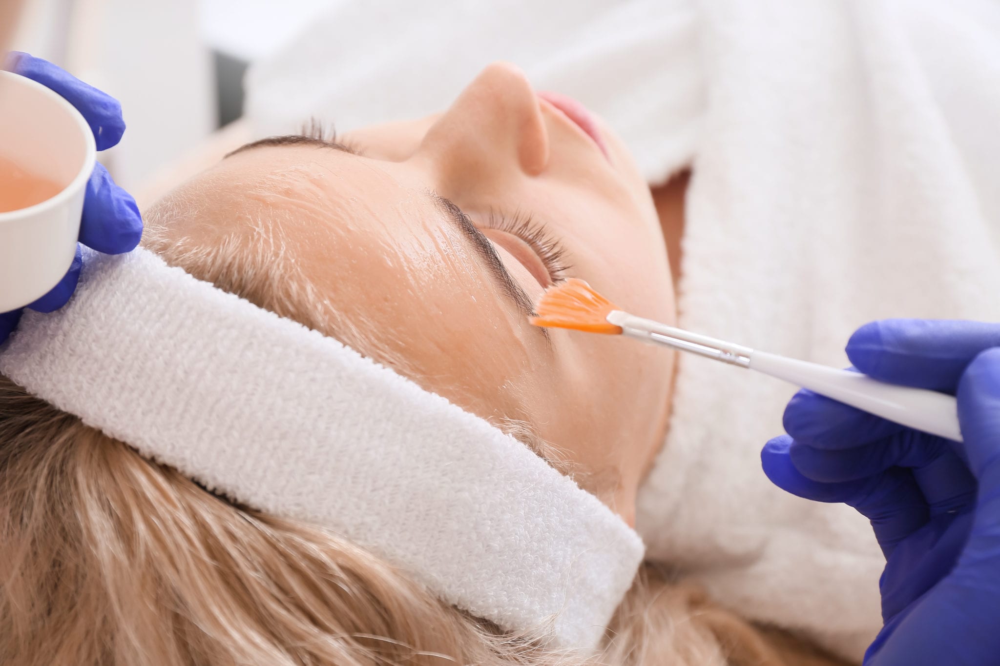 Chemical Peels in Austin, TX